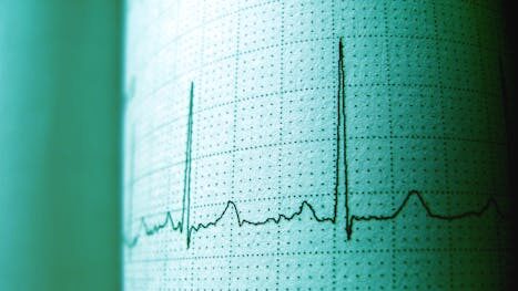 Close-up of an ECG printout displaying heartbeat rhythm and frequency for medical analysis.