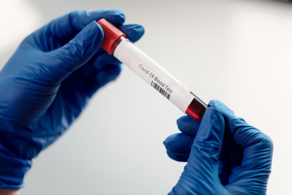 Laboratory technician holding a Covid-19 blood test sample in test tube.