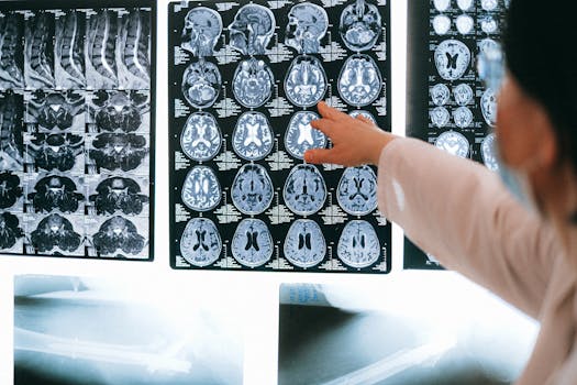 Radiologist pointing at brain MRI scans showing detailed medical examination.