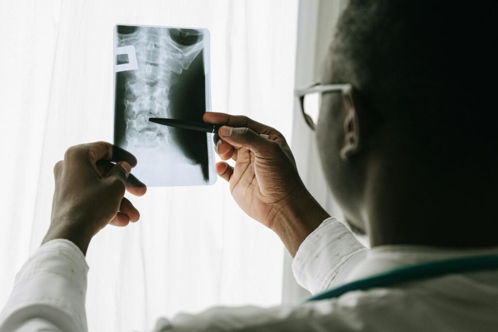 Close-up of a doctor examining a spine X-ray film with a pen in a hospital setting.